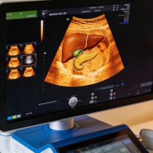 3D/4D ULTRASOUND UPPER ABDOMEN
